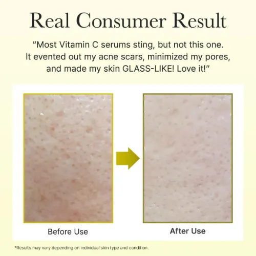 arencia-vitamin-c-booster-serum-30_1205_56cw.webp
