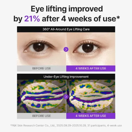 centellian24-360-shot-pdrn-eye-crea_1205_6dqv.webp