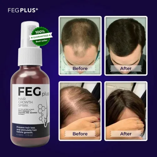 feg-plus-hair-growth-spray_1205_nkt0.webp