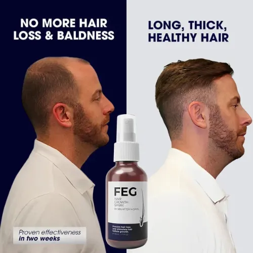 feg-plus-hair-growth-spray_1205_nkt0.webp